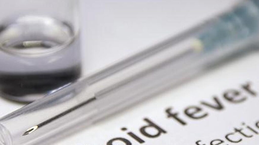 Antibiotic resistance fuels 87% of India’s typhoid economic burden: Study