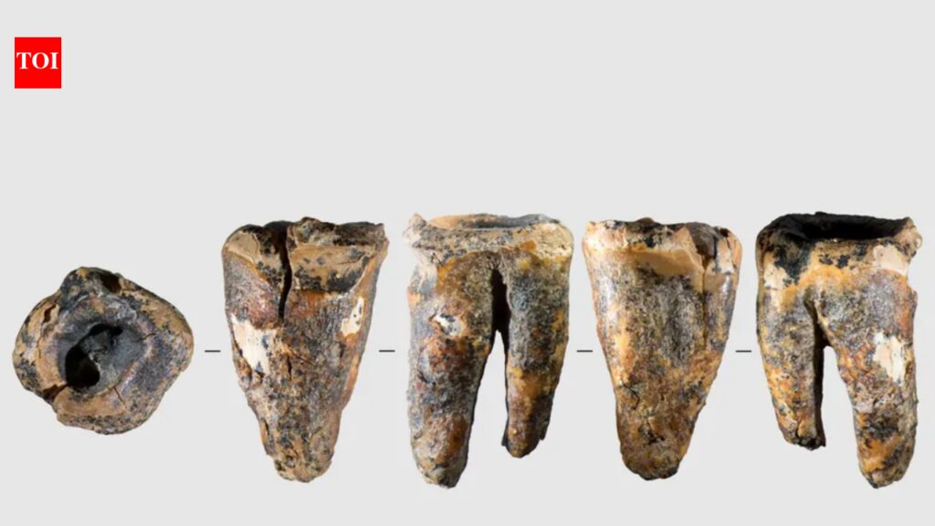 Neanderthals were performing dental surgery nearly 60,000 years ago and it surprisingly worked