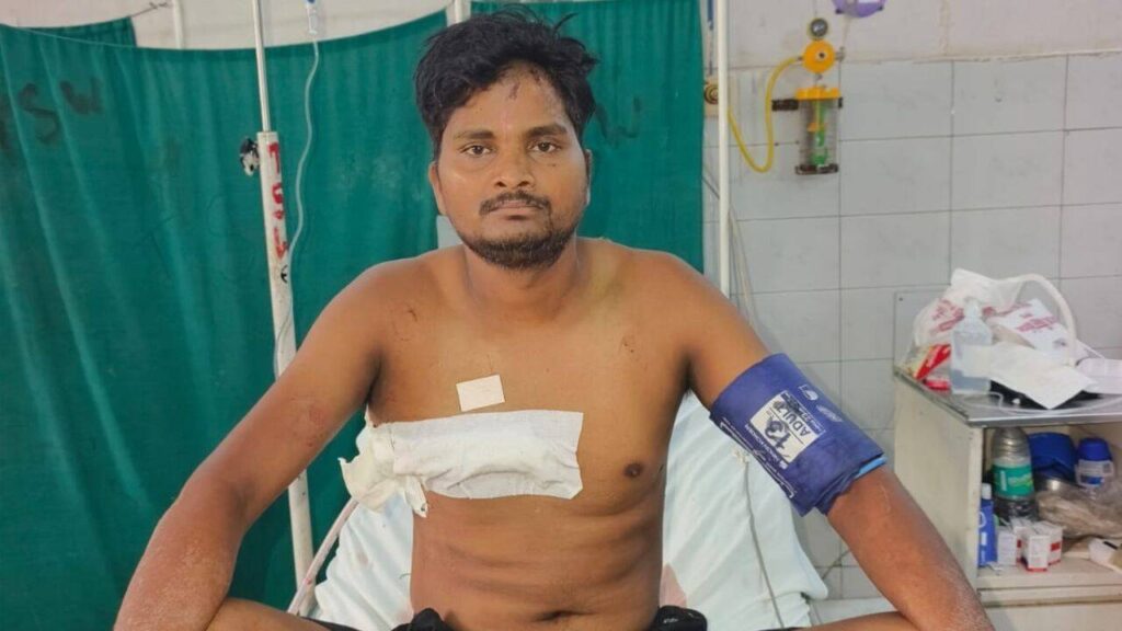 13-cm knife lodged in chest, nicks lung; KGMU doctors save man’s life | Lucknow News