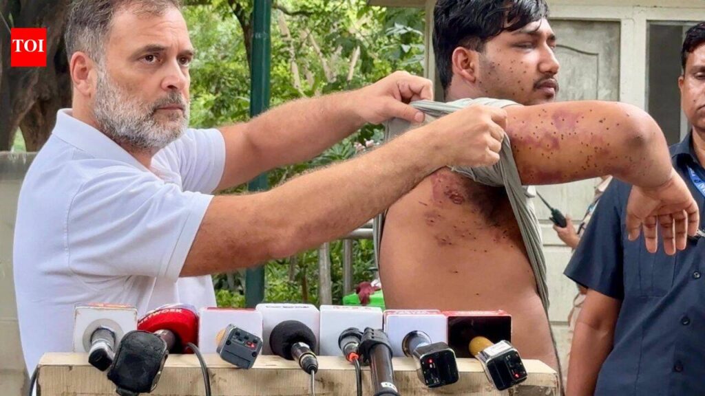 ‘His eye suffered damage’: Rahul Gandhi brings alleged pellet gun victim before media, renews call to sack Pradhan | India News