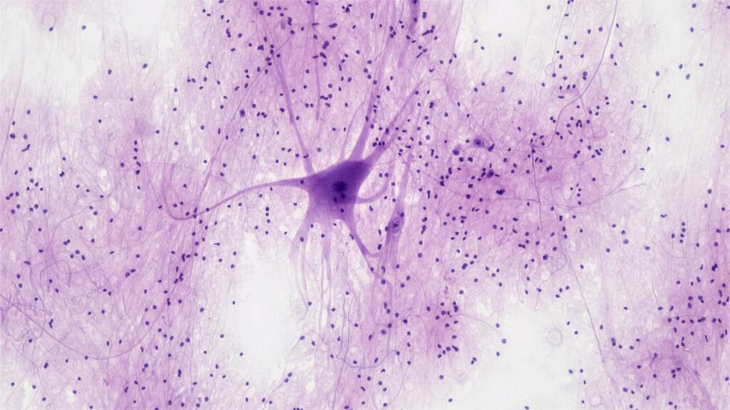 Are new neurons born in the adult human brain? Study revives debate